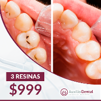 Auxilio Dental Playa