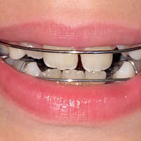 Bukkadent Odontología Avanzada (dentista)