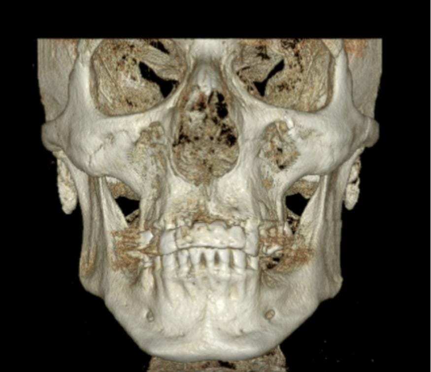 Voxel Dental Radiology dental clinic in Playa Del Carmen