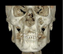 Voxel Dental Radiology in Playa Del Carmen