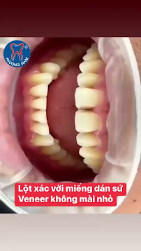 Nha khoa Phương Nam 325 Nguyễn Trãi Thanh Xuân Hà Nội