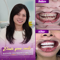 Nha khoa Thẩm mỹ Quốc tế VNES DENTAL (Vnes 歯科クリニック)