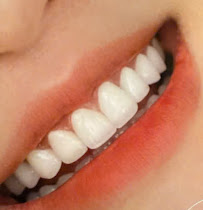 Nha Khoa Be Dental - PREMIUM DENTAL CLINIC