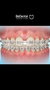 Nha Khoa Be Dental - PREMIUM DENTAL CLINIC