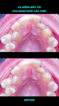 Nha Khoa Be Dental - PREMIUM DENTAL CLINIC