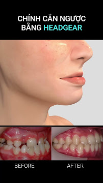 Nha Khoa Be Dental - PREMIUM DENTAL CLINIC