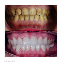 Nha khoa SEA Dental