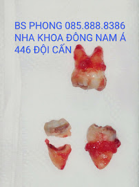 Nha khoa SEA Dental