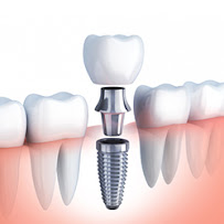 Navii Dental Care