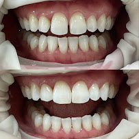 Hanseoul dental clinnic