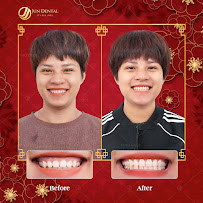 Nha Khoa Thẩm Mỹ Hàn Quốc Jun Dental