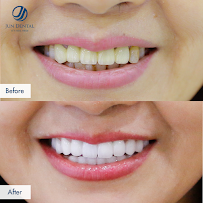 Nha Khoa Thẩm Mỹ Hàn Quốc Jun Dental