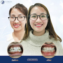 Nha Khoa Thẩm Mỹ Hàn Quốc Jun Dental