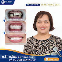 Nha Khoa Thẩm Mỹ Hàn Quốc Jun Dental