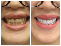 LIEN THANH DENTAL CLINIC