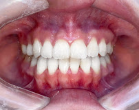 NHA KHOA TRANG DUNG DENTAL UY TÍN TẠI HÀ NỘI - CHUYÊN TRỒNG RĂNG IMPLANT, BỌC RĂNG SỨ, NIỀNG RĂNG, NHỔ RĂNG KHÔN