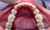 NHA KHOA TRANG DUNG DENTAL UY TÍN TẠI HÀ NỘI - CHUYÊN TRỒNG RĂNG IMPLANT, BỌC RĂNG SỨ, NIỀNG RĂNG, NHỔ RĂNG KHÔN