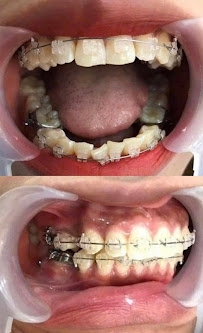 NHA KHOA TRANG DUNG DENTAL UY TÍN TẠI HÀ NỘI - CHUYÊN TRỒNG RĂNG IMPLANT, BỌC RĂNG SỨ, NIỀNG RĂNG, NHỔ RĂNG KHÔN
