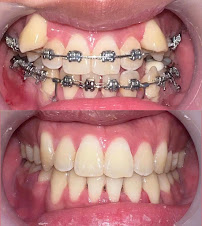NHA KHOA TRANG DUNG DENTAL UY TÍN TẠI HÀ NỘI - CHUYÊN TRỒNG RĂNG IMPLANT, BỌC RĂNG SỨ, NIỀNG RĂNG, NHỔ RĂNG KHÔN