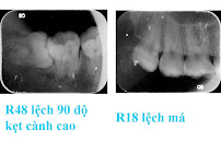 Nha Khoa Bảo Việt 117 Trần Đăng Ninh