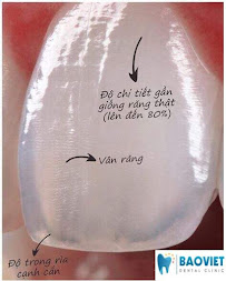 Nha Khoa Bảo Việt 117 Trần Đăng Ninh