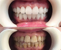BeDental – International Dental Clinic in Hanoi