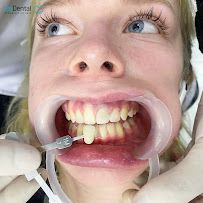 BeDental - Nha Khoa Uy Tín Quận 1 , chuyên bọc răng sứ, cạo vôi răng, tẩy trắng răng, niềng răng