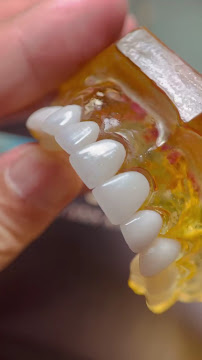 BeDental - Nha Khoa Uy Tín Quận 1 , chuyên bọc răng sứ, cạo vôi răng, tẩy trắng răng, niềng răng