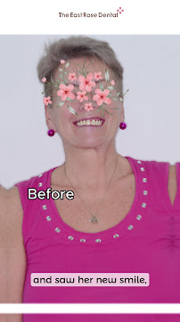 Dental Roses