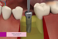 I-Dent Dental