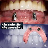 Nhi Nguyen Dental