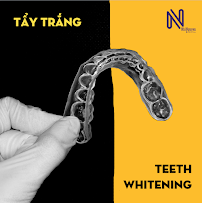 Nhi Nguyen Dental