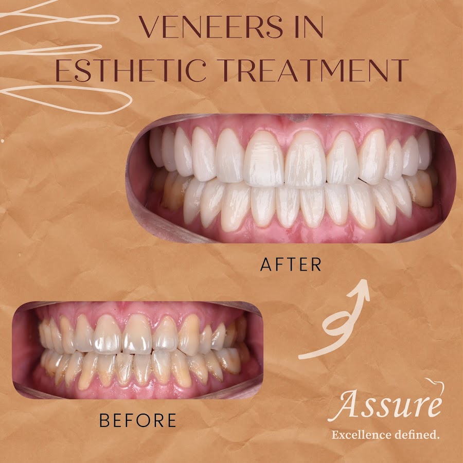Assure Dental Clinic dental clinic