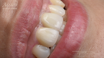 Assure Dental Clinic