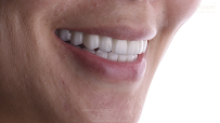 Assure Dental Clinic