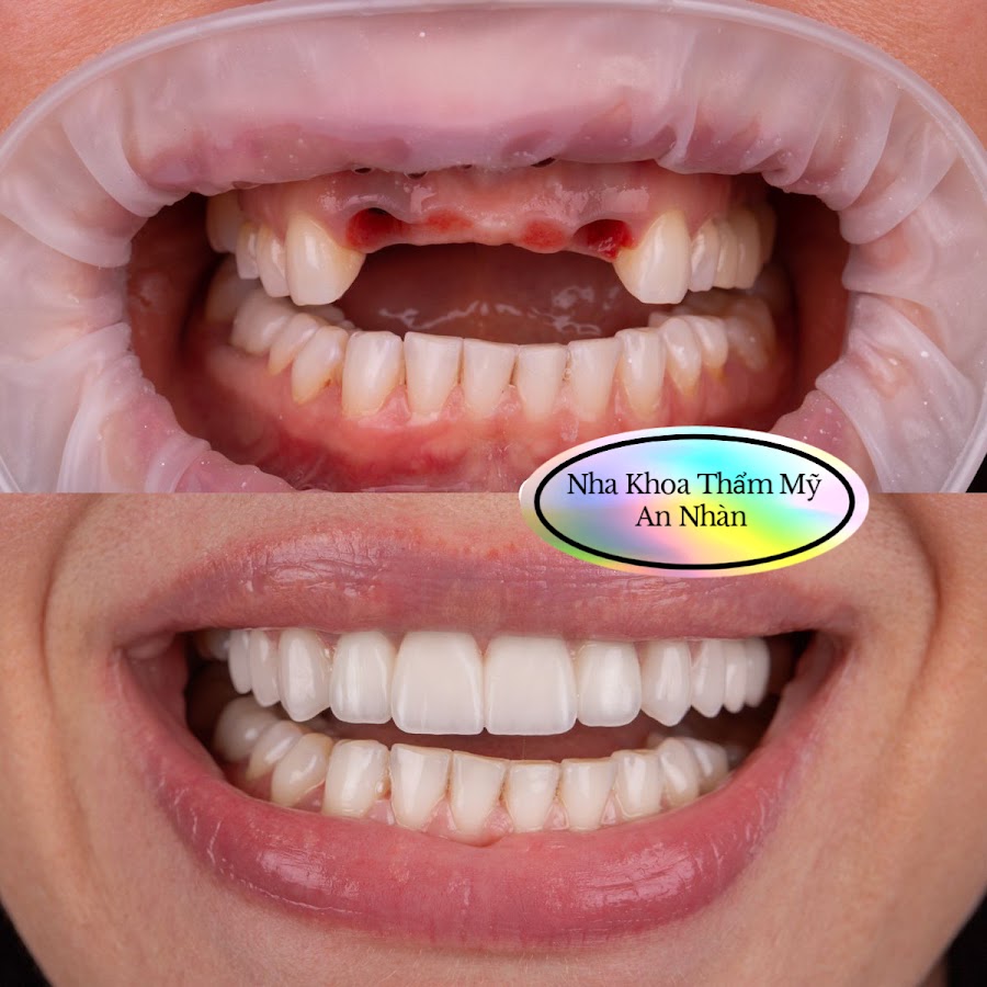 An Nhan Dental dental clinic