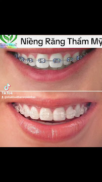 Nha khoa An Nhàn - Nha Khoa Gần Đây - chuyên nhổ răng khôn - Niềng Răng xinh đẹp - Răng sứ Cao Cấp toàn hàm.