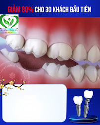 Nha khoa An Nhàn - Nha Khoa Gần Đây - chuyên nhổ răng khôn - Niềng Răng xinh đẹp - Răng sứ Cao Cấp toàn hàm.