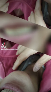 Nha Khoa An Nhàn 2 - Nha Khoa gần đây - chuyên Nhổ Răng khôn - Niềng Răng xinh đẹp - Trồng Răng sứ Cao Cấp.