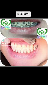 Nha Khoa An Nhàn 2 - Nha Khoa gần đây - chuyên Nhổ Răng khôn - Niềng Răng xinh đẹp - Trồng Răng sứ Cao Cấp.