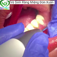 Nha Khoa An Nhàn 2 - Nha Khoa gần đây - chuyên Nhổ Răng khôn - Niềng Răng xinh đẹp - Trồng Răng sứ Cao Cấp.