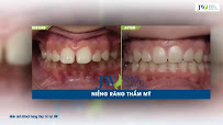 Khoa Răng Hàm Mặt - Bệnh Viện JW Hàn Quốc