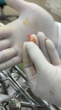 Dental Cercon