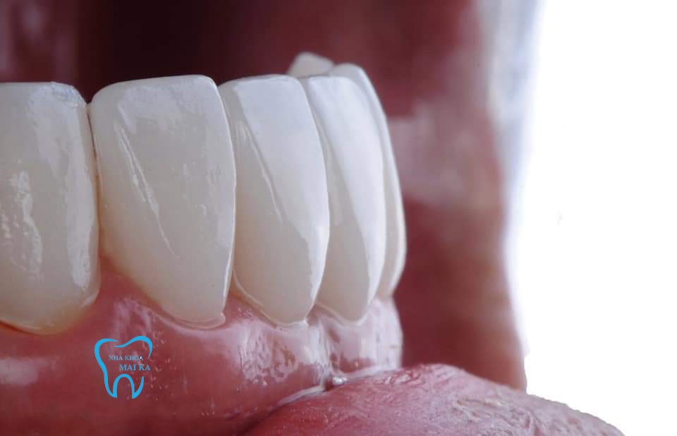Nha Khoa MaiKa dental clinic