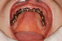 Dental Thi Nghe 2