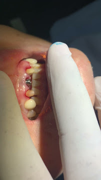 Bác sĩ nha khoa Implant Minh Đức