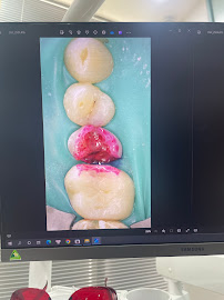 Presmile Dental Center - Chỉnh Nha Khay Trong, Răng Đẹp Tự Nhiên