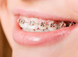 Trung tâm Implant Nhân Tâm