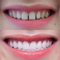 Airline Dental - Chi nhánh Quận 5, TPHCM