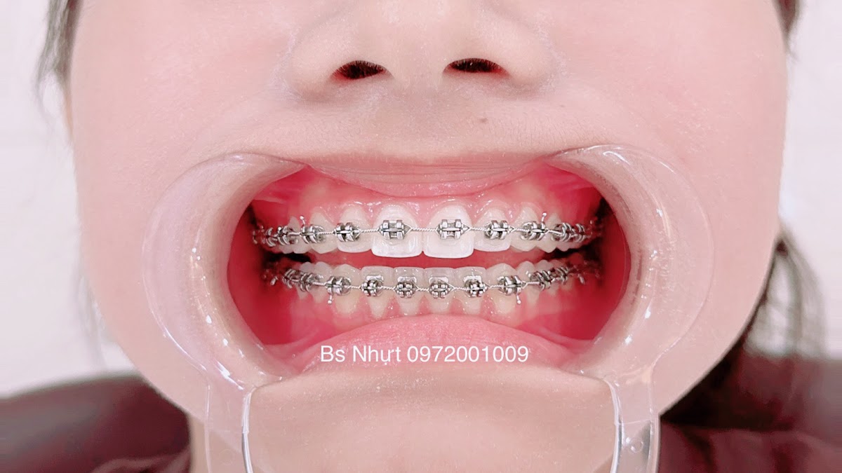 Nha Khoa Minh Nhut dental clinic